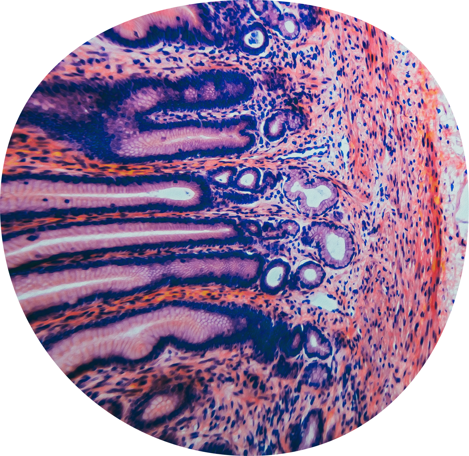 Free Androgen Index (FAI)-1